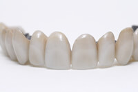 Dentures - Prothesis - 02